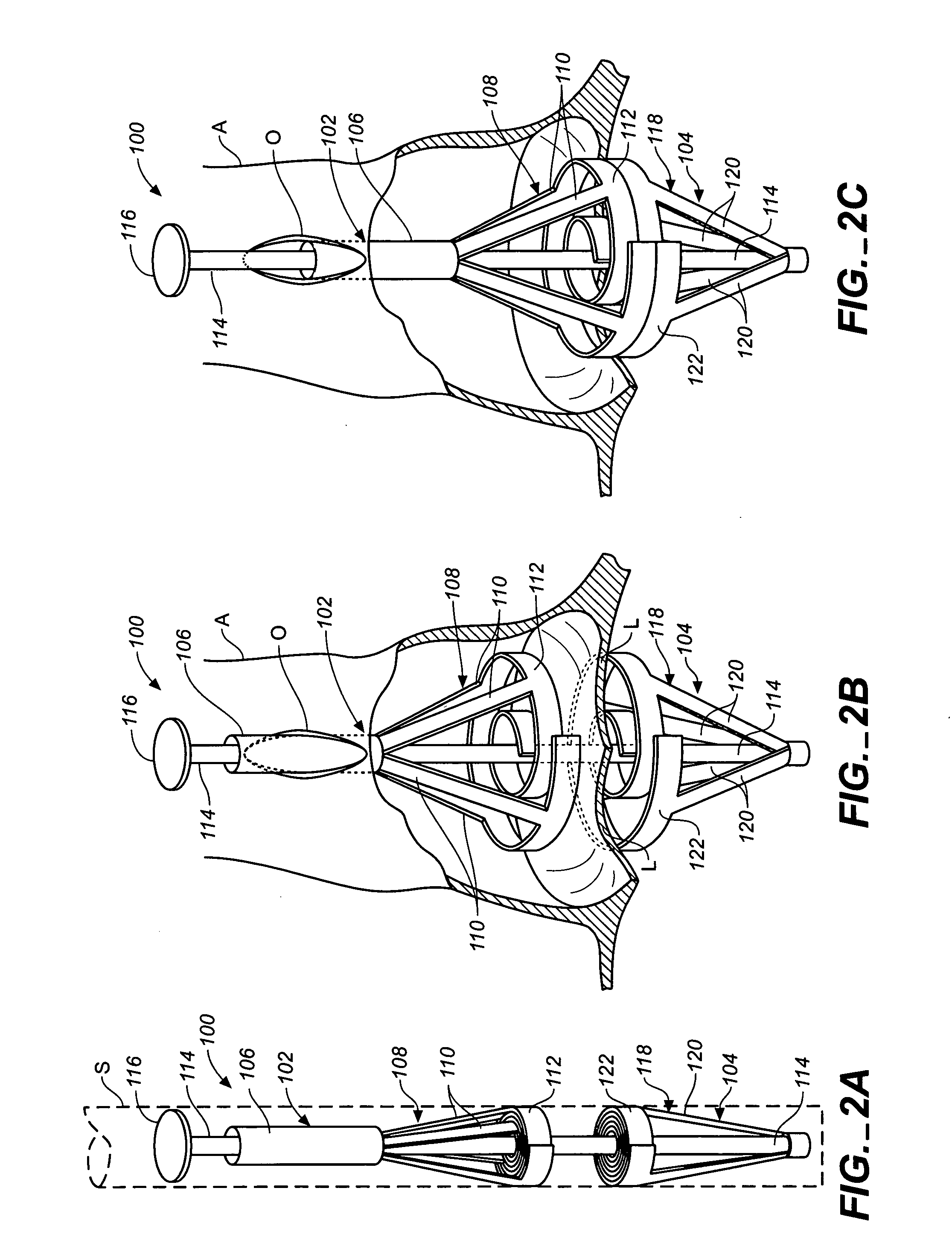 Apparatus and methods for minimally invasive valve surgery