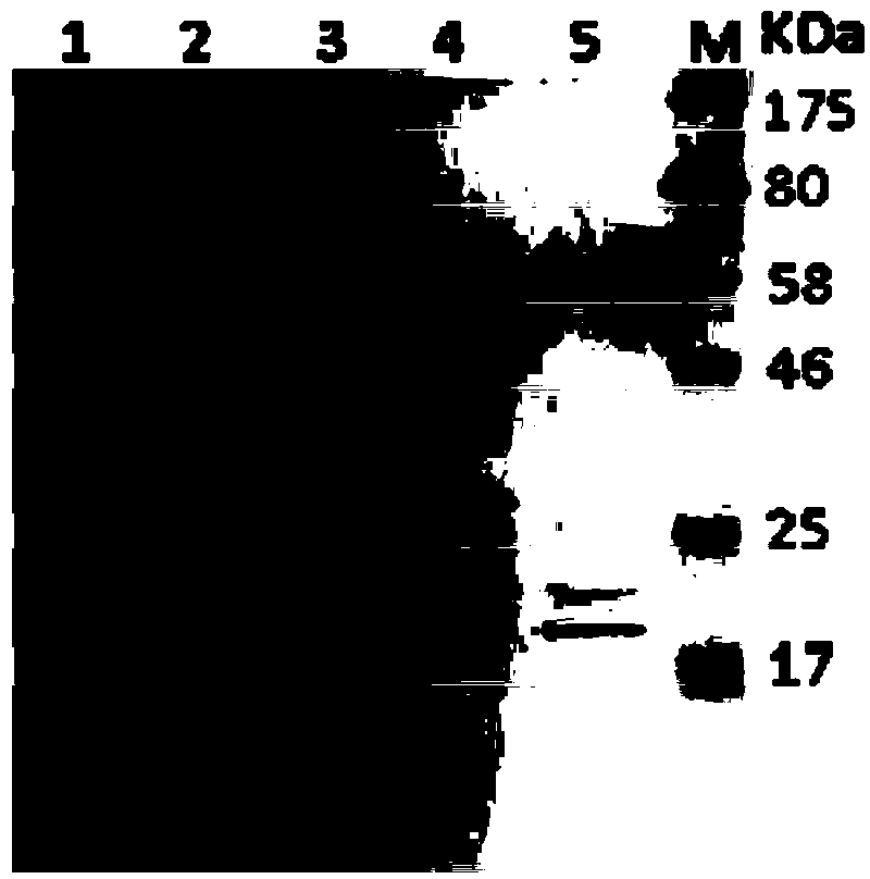 Amylase, and encoding gene and application thereof