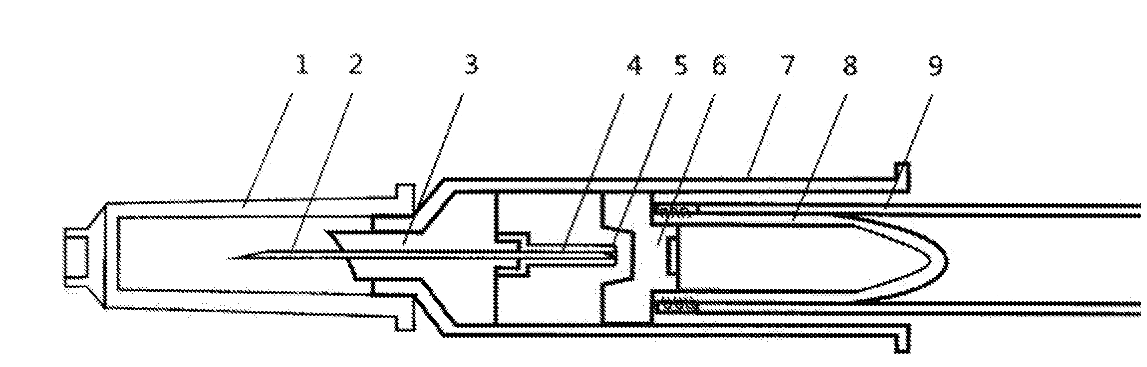 A Disposable Negative-pressure Anterior Chamber Paracentesis syringe