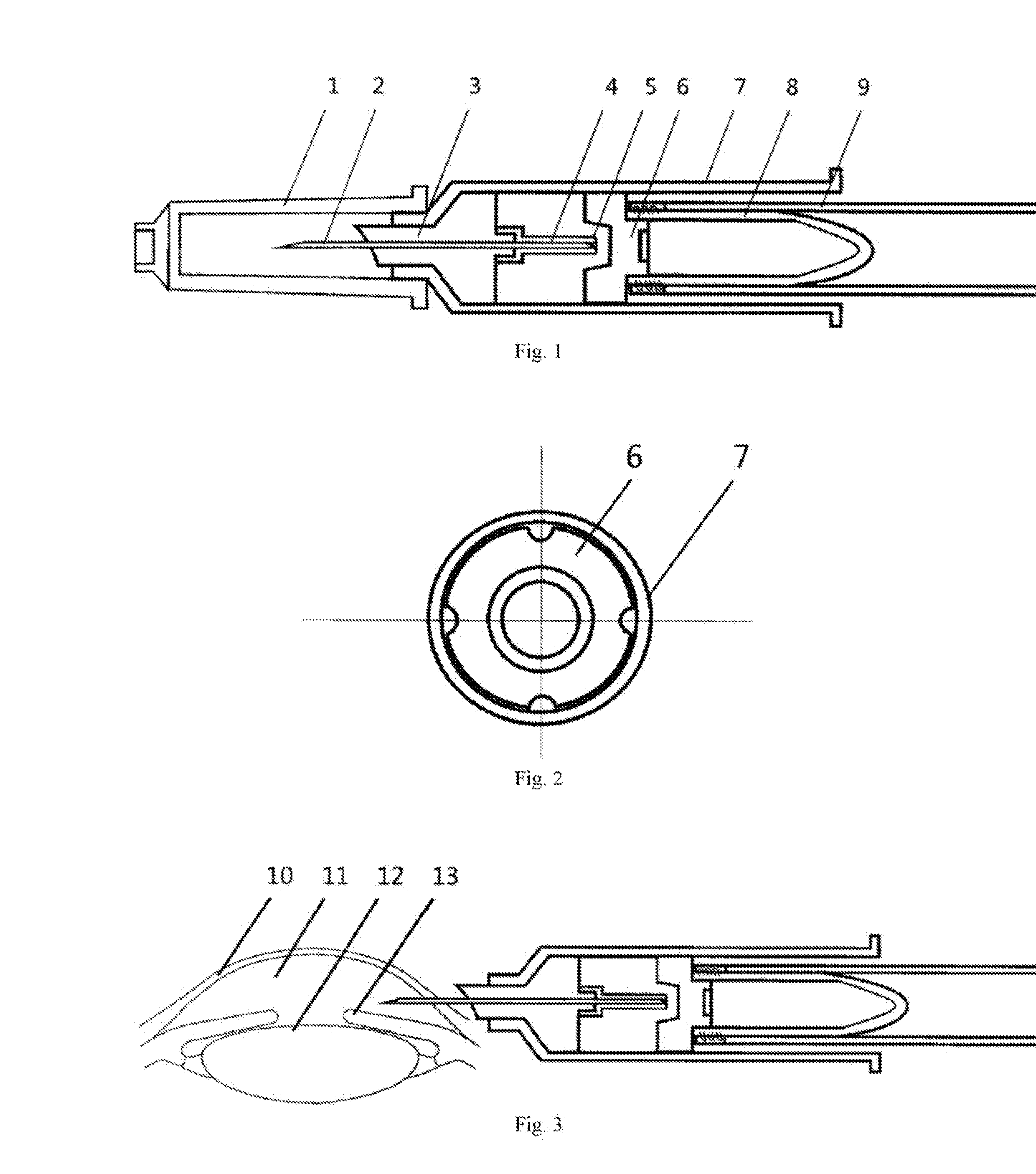 A Disposable Negative-pressure Anterior Chamber Paracentesis syringe