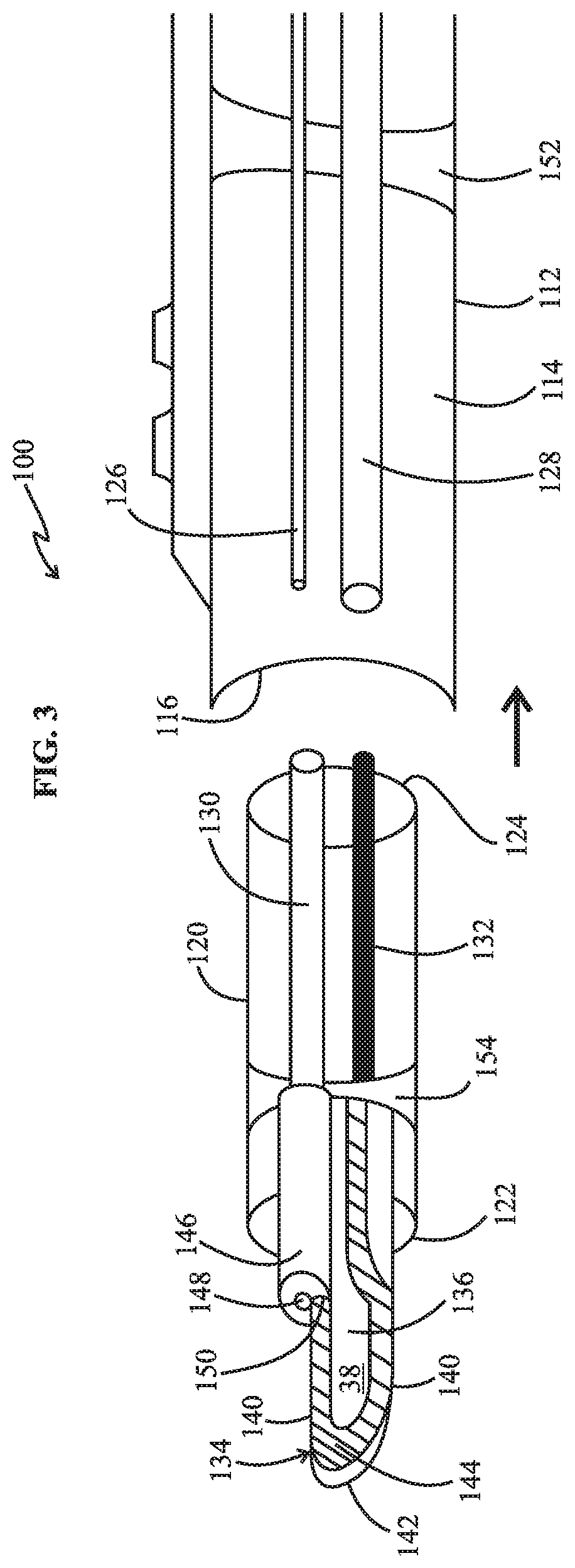 Monopolar electrosurgery pencil with argon beam capability