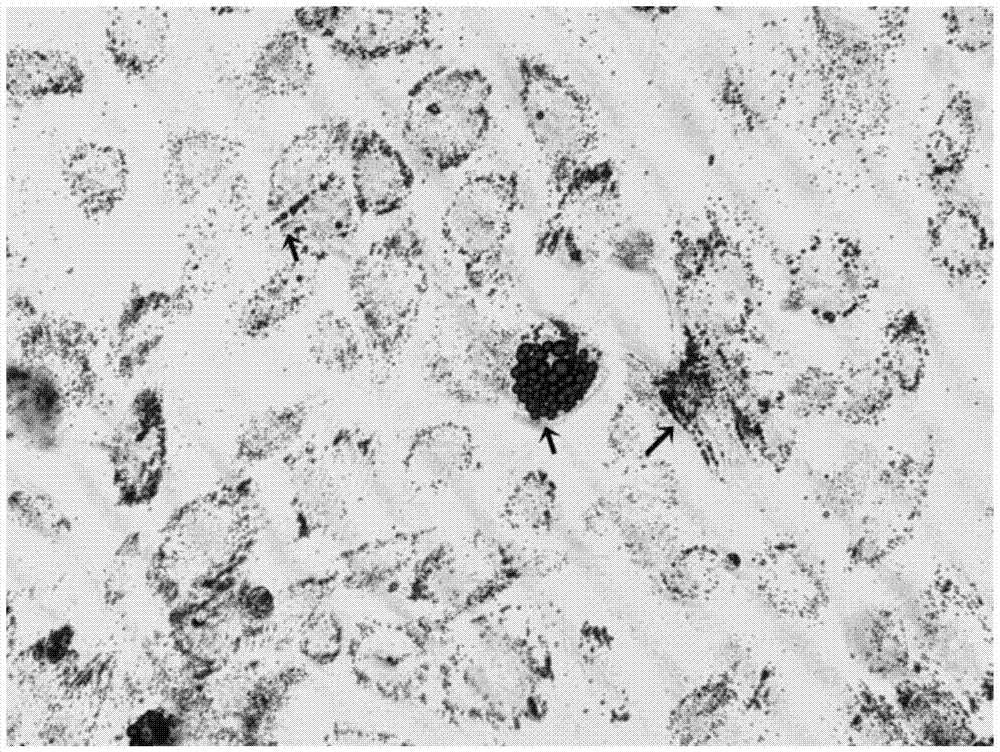 A method for isolating and cultivating umbilical cord mesenchymal stem cells