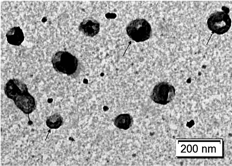 Preparation method of Escherichia coli inner membrane vesicles endogenously highly expressing miRNA and its application in the preparation of antitumor drugs