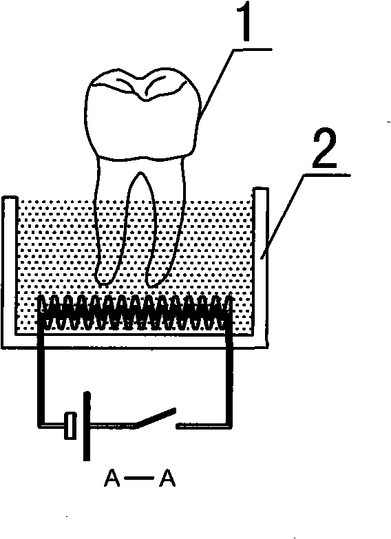 Method for producing macromolecule orthodontic tooth crown