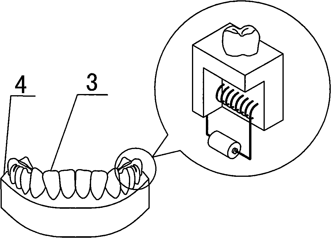 Method for producing macromolecule orthodontic tooth crown