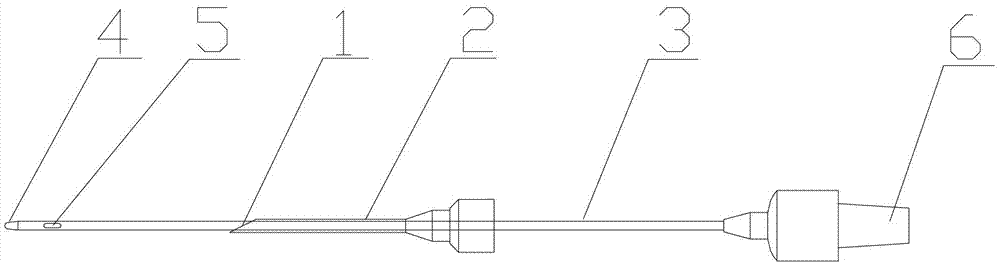 Thoracocentesis drainage needle