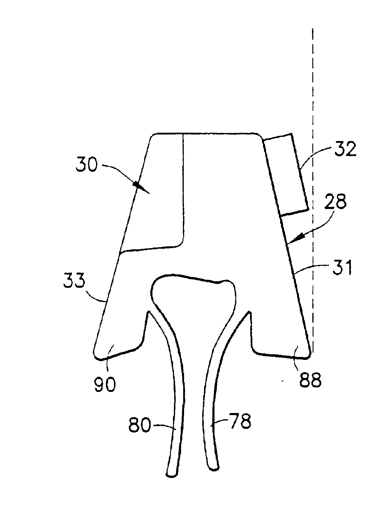 Reclosable packaging having zipper with sculpted slider end stops