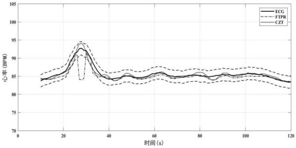 Non-contact accurate heart rate detection method based on 77GHz millimeter wave radar