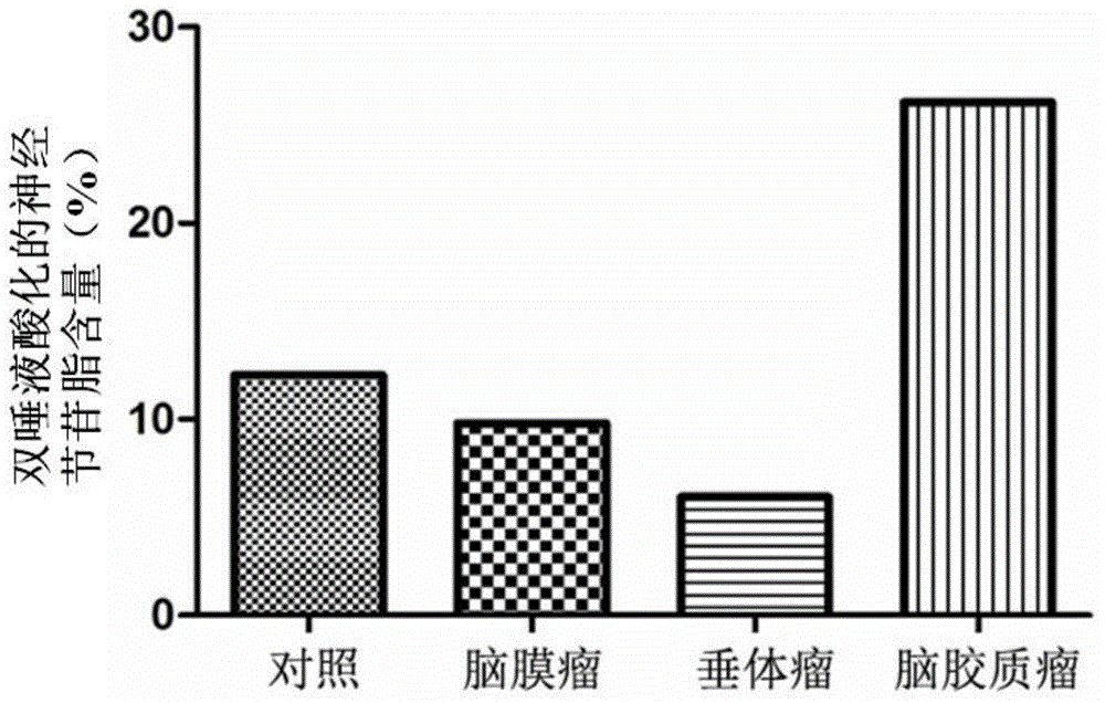 Glioma tumor marker and application thereof