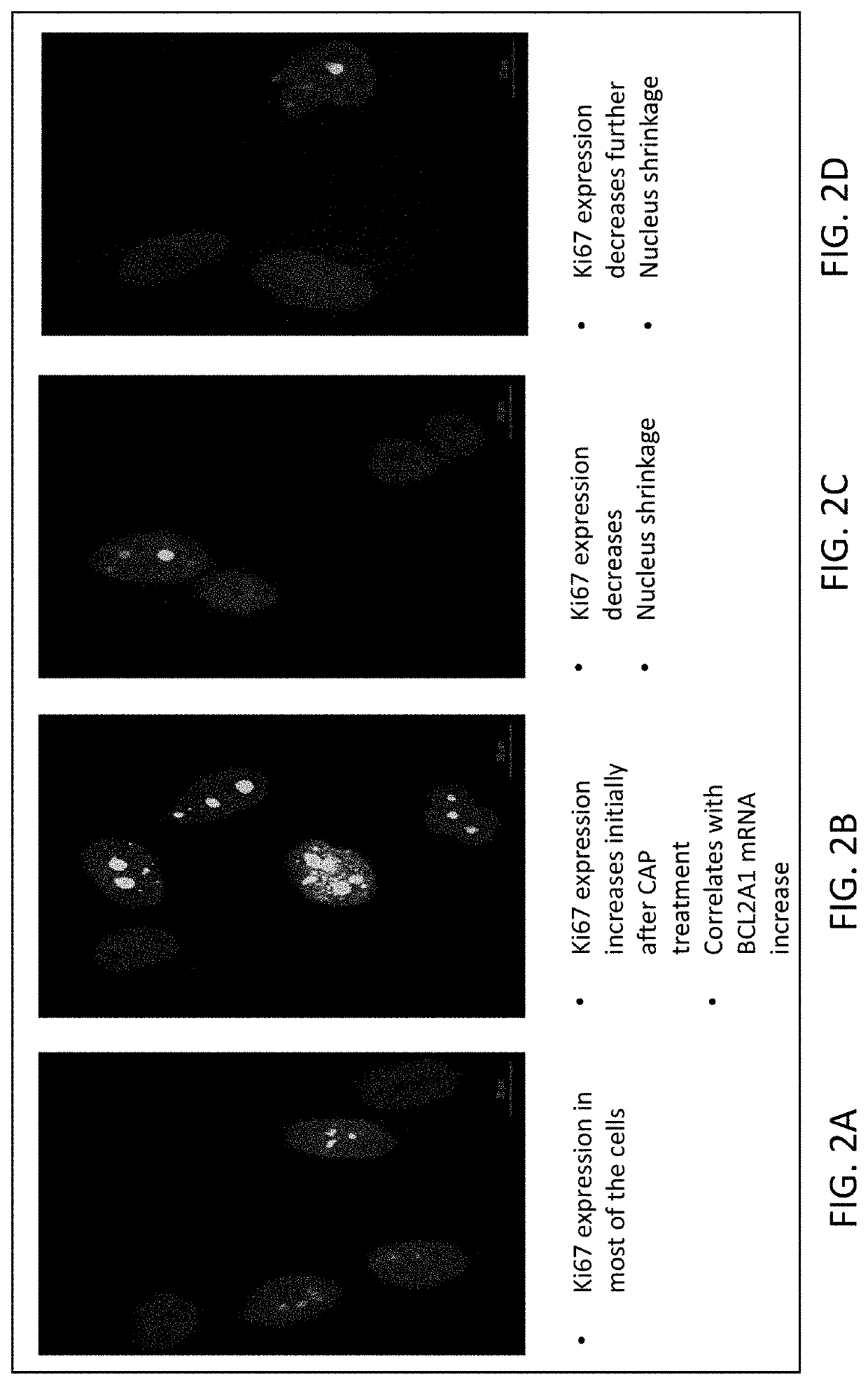 System and method for suppressing apoe gene for sarcoma treatment