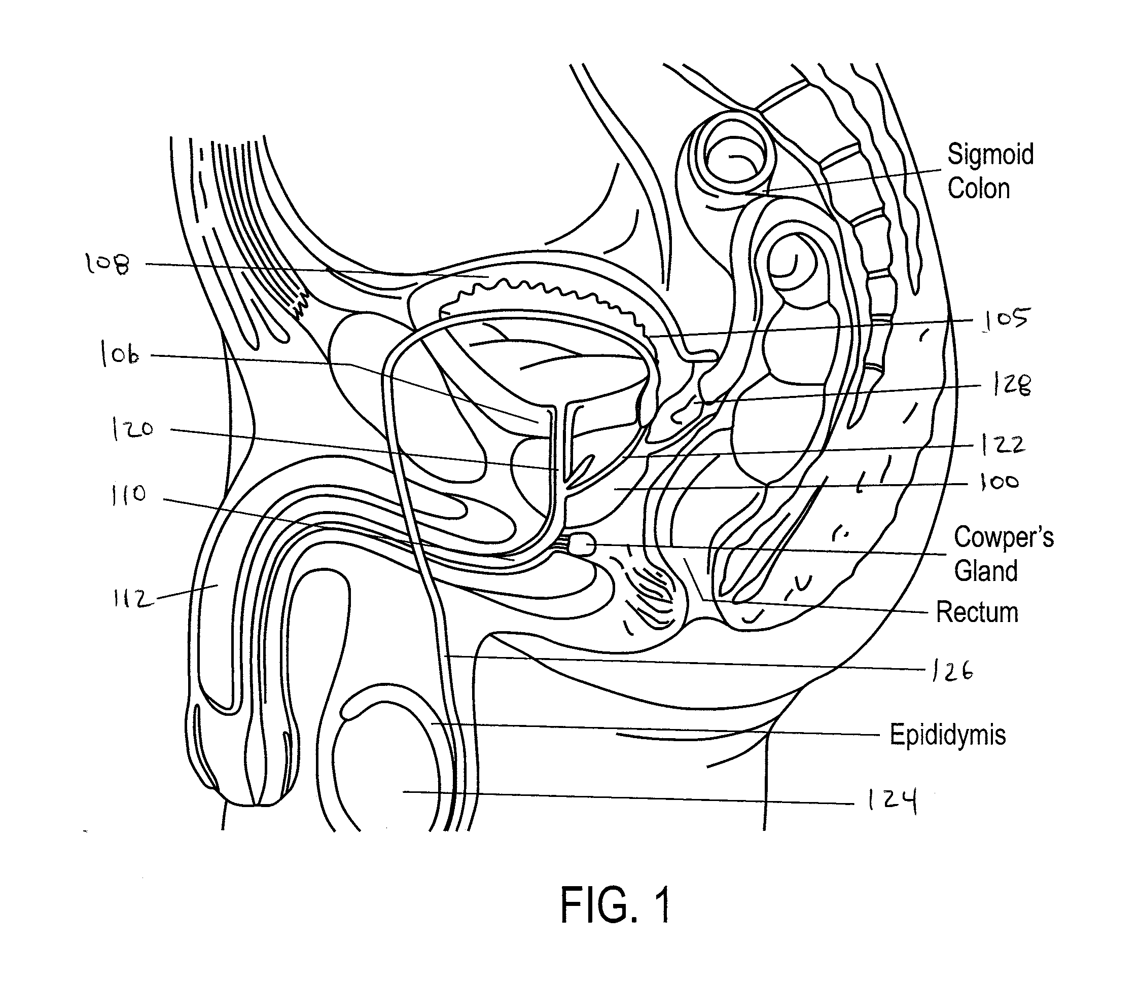 Systems and Methods for Prostate Treatment