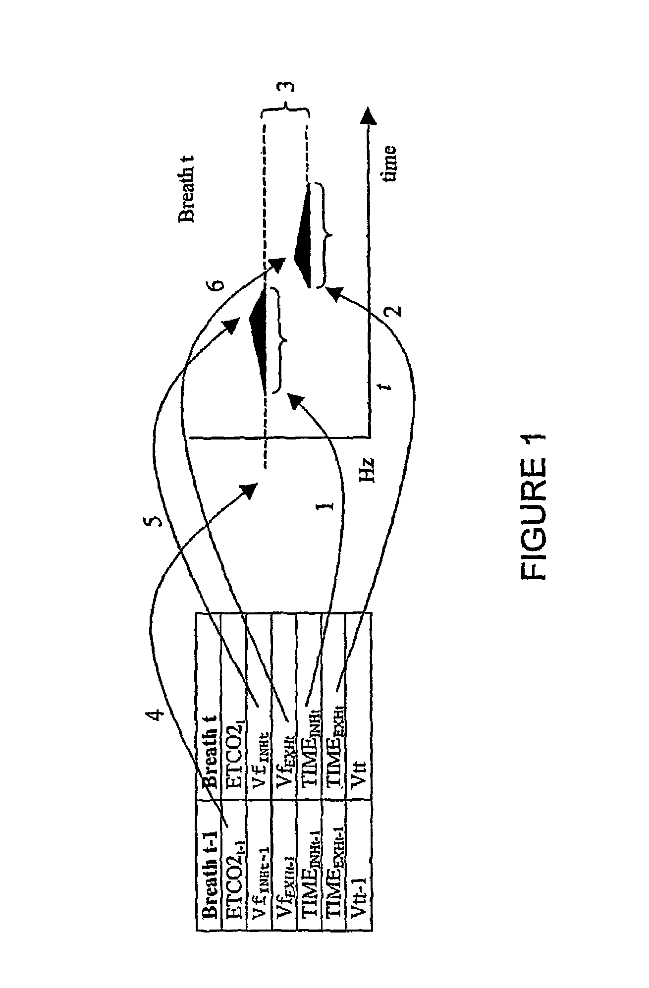 Method and means of physiological monitoring using sonification