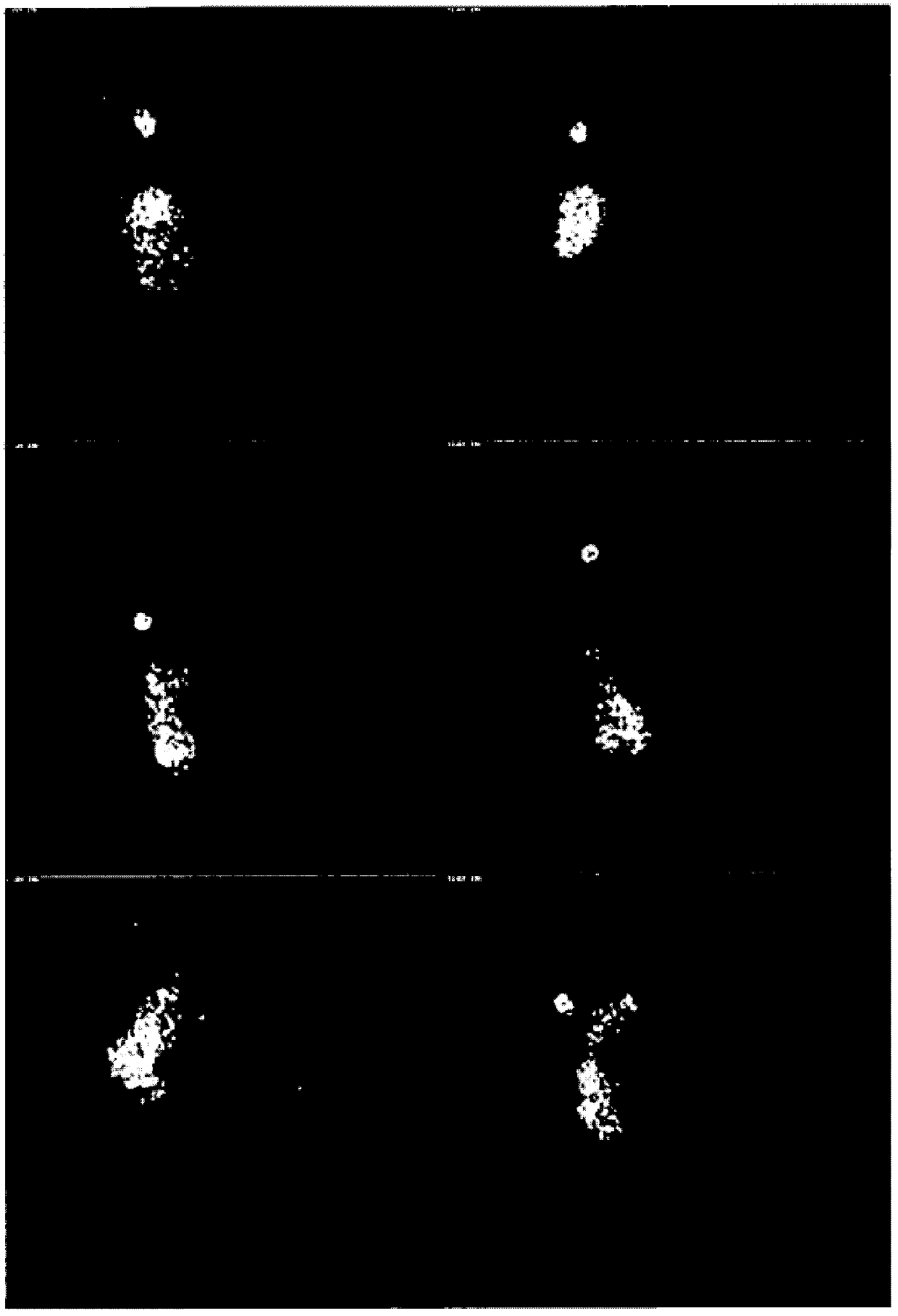 Solid compositions comprising 5-aminolevulinic acid