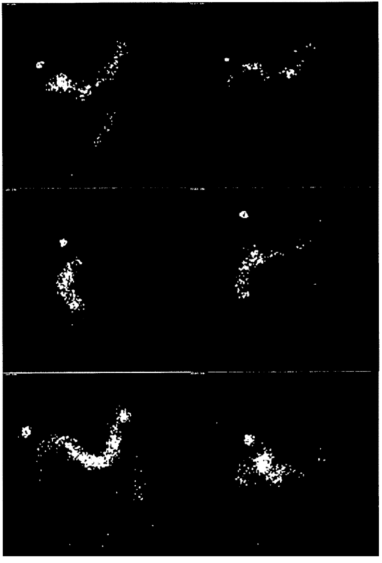 Solid compositions comprising 5-aminolevulinic acid