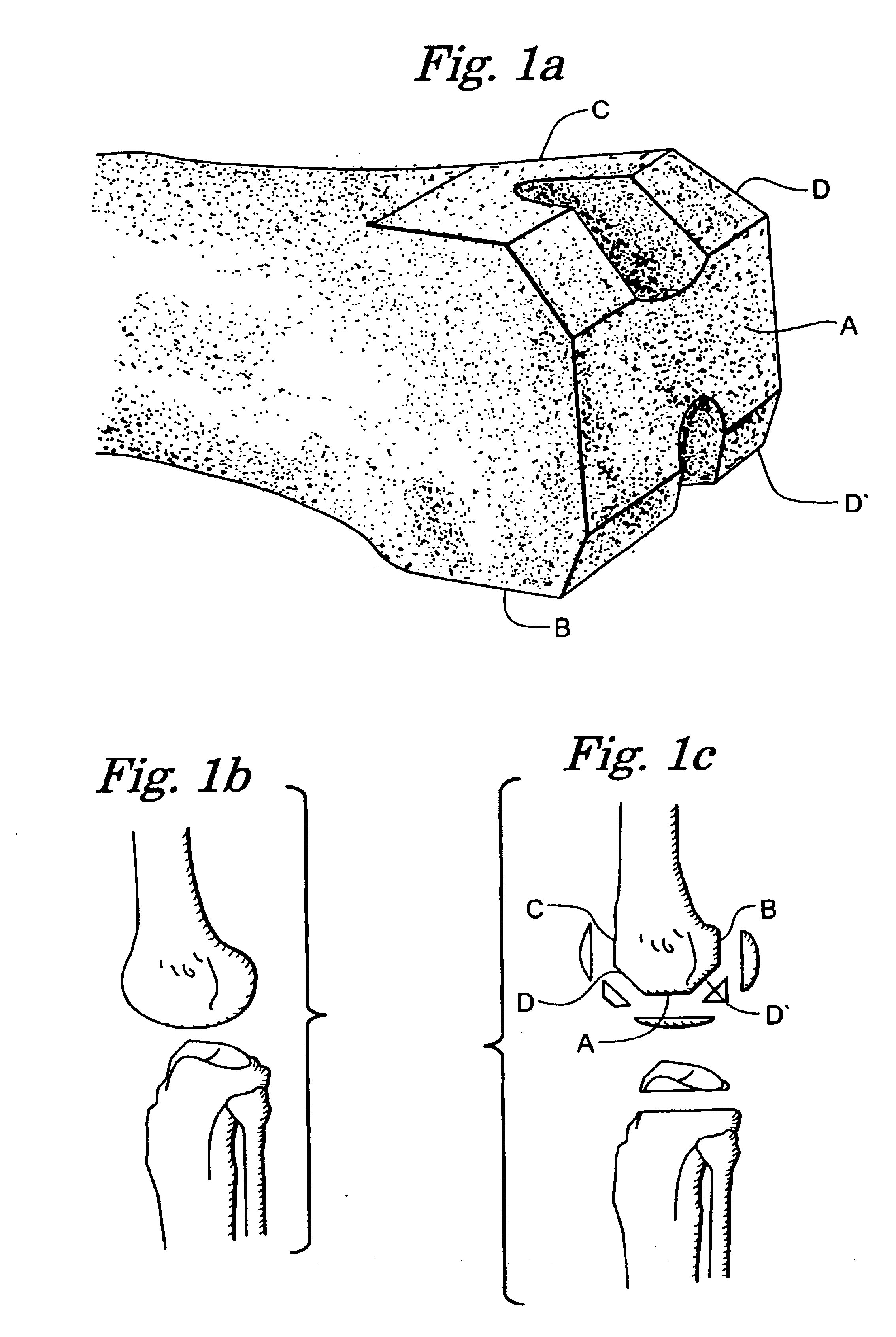 Rotating track cutting guide system