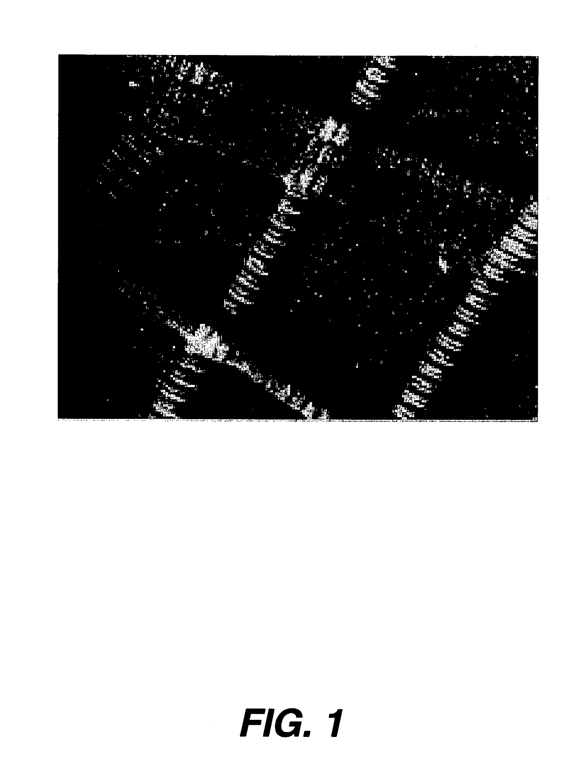 Method for stromal corneal repair and refractive alteration