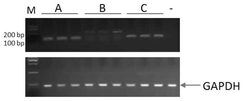 A kind of rhodosporidium toruloides rna polymerase type III promoter and application thereof