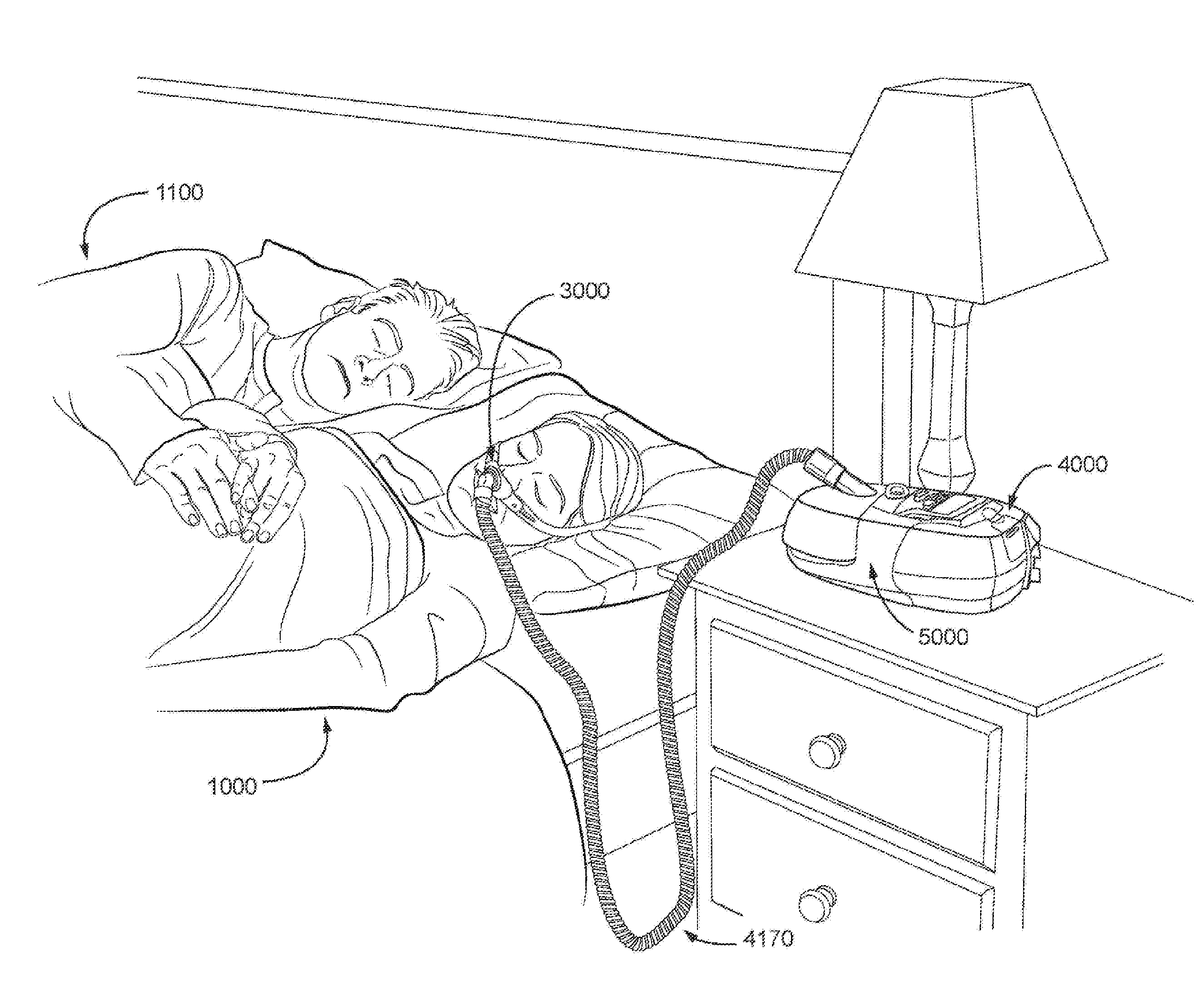 A respiratory pressure treatment system