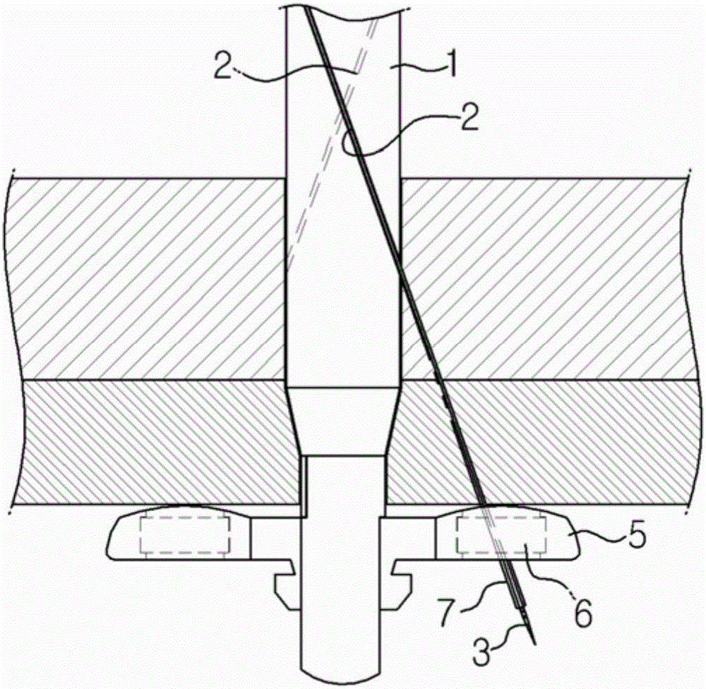 Laparoscopic port site closing apparatus