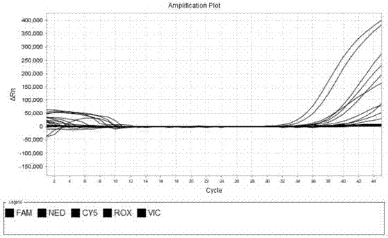 Kit for predicting prostate screening and lymphatic metastasis