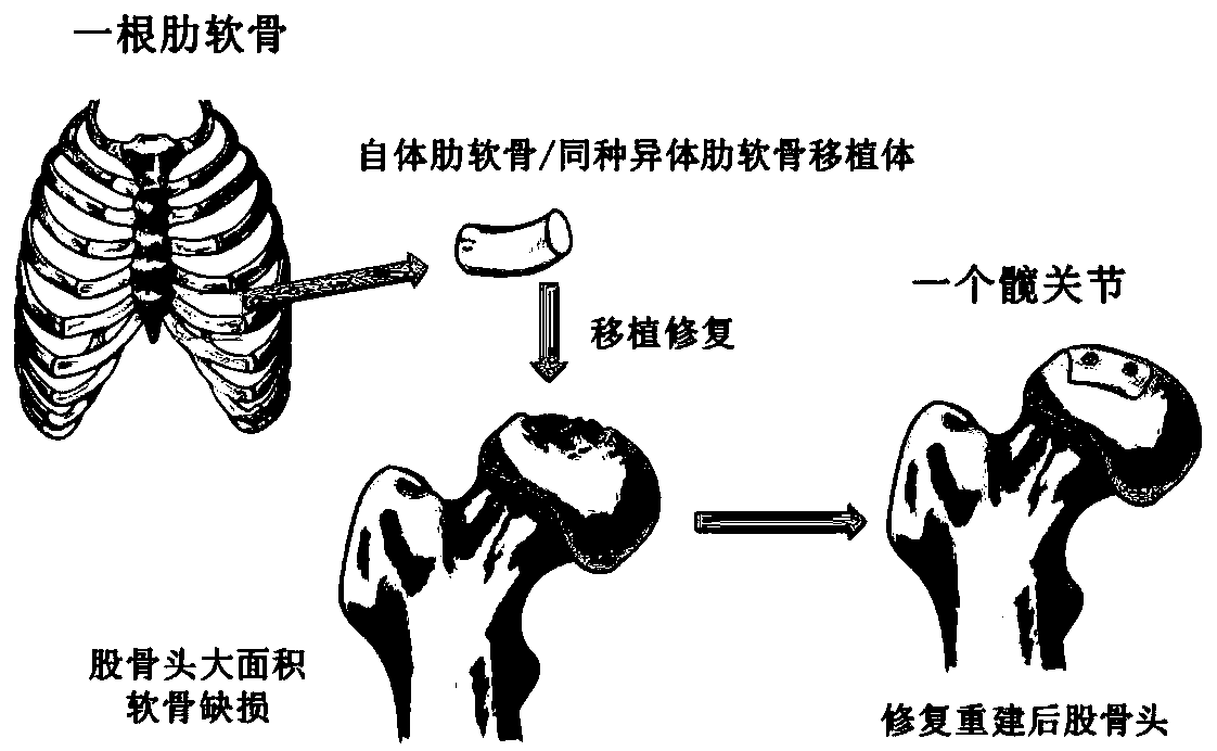 Transplant and method for repairing articular cartilage defects