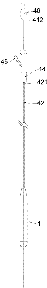 Gastric fluid director and support thereof