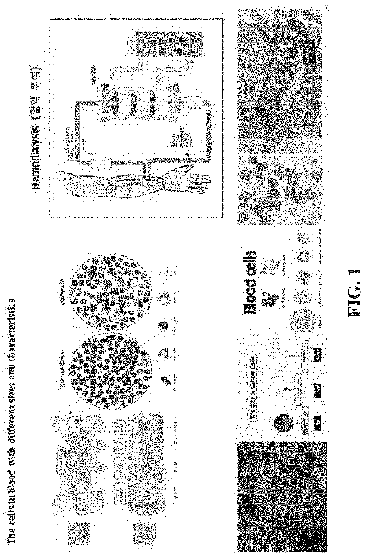 Apparatus and method for microwave therapy for blood cancer treatment