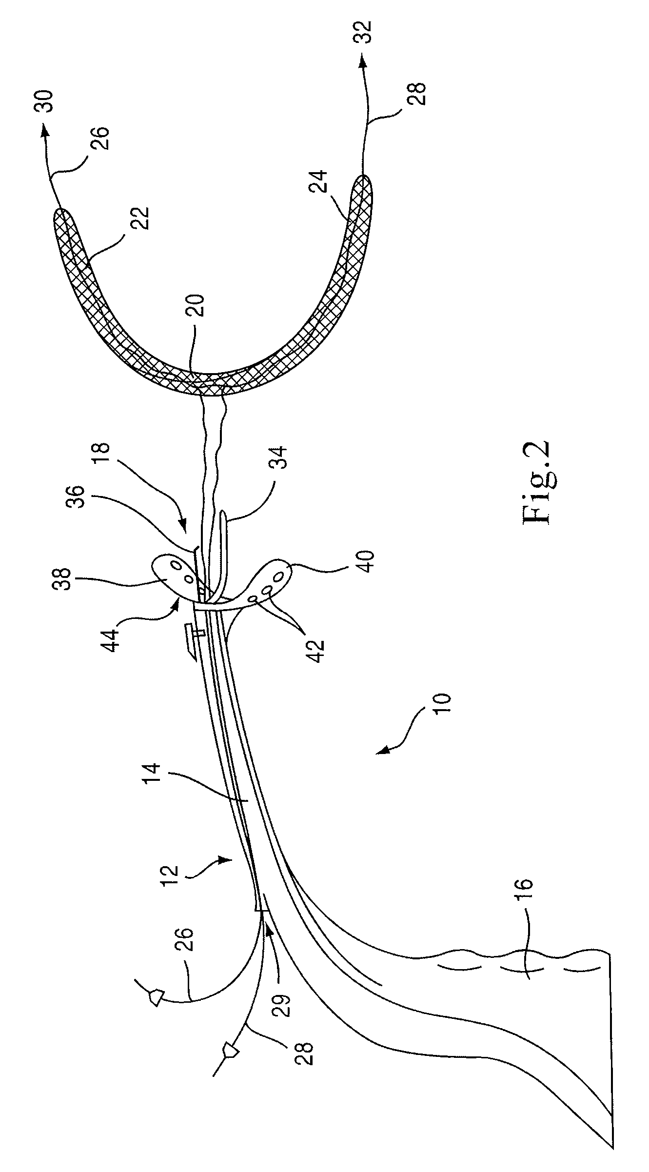 Apparatus and method for suspending a uterus