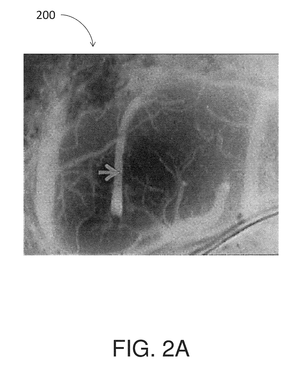 Systems for imaging of blood flow in laparoscopy