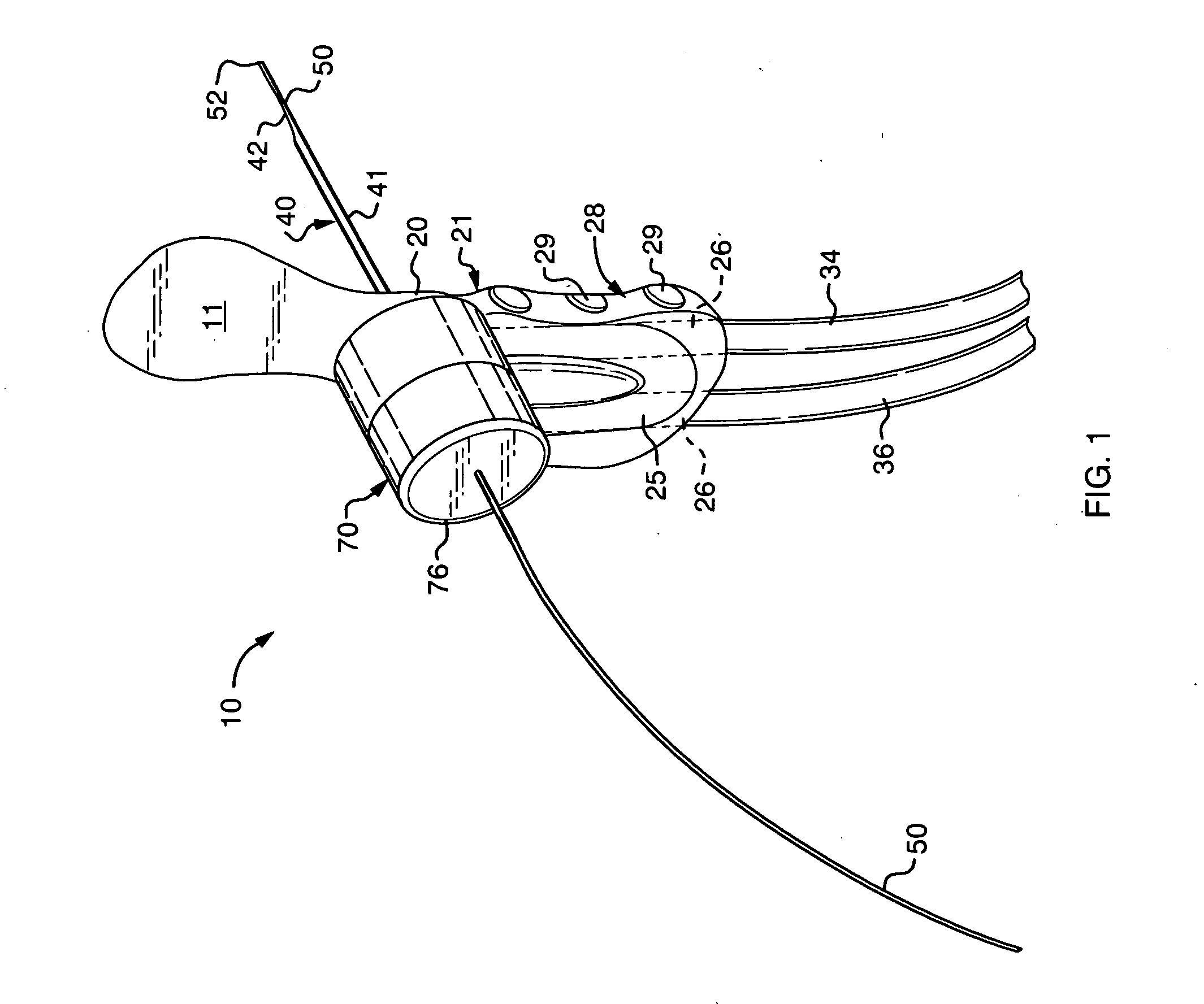 Ductal lavage microcatheter with user activated valve and Nitinol introducer