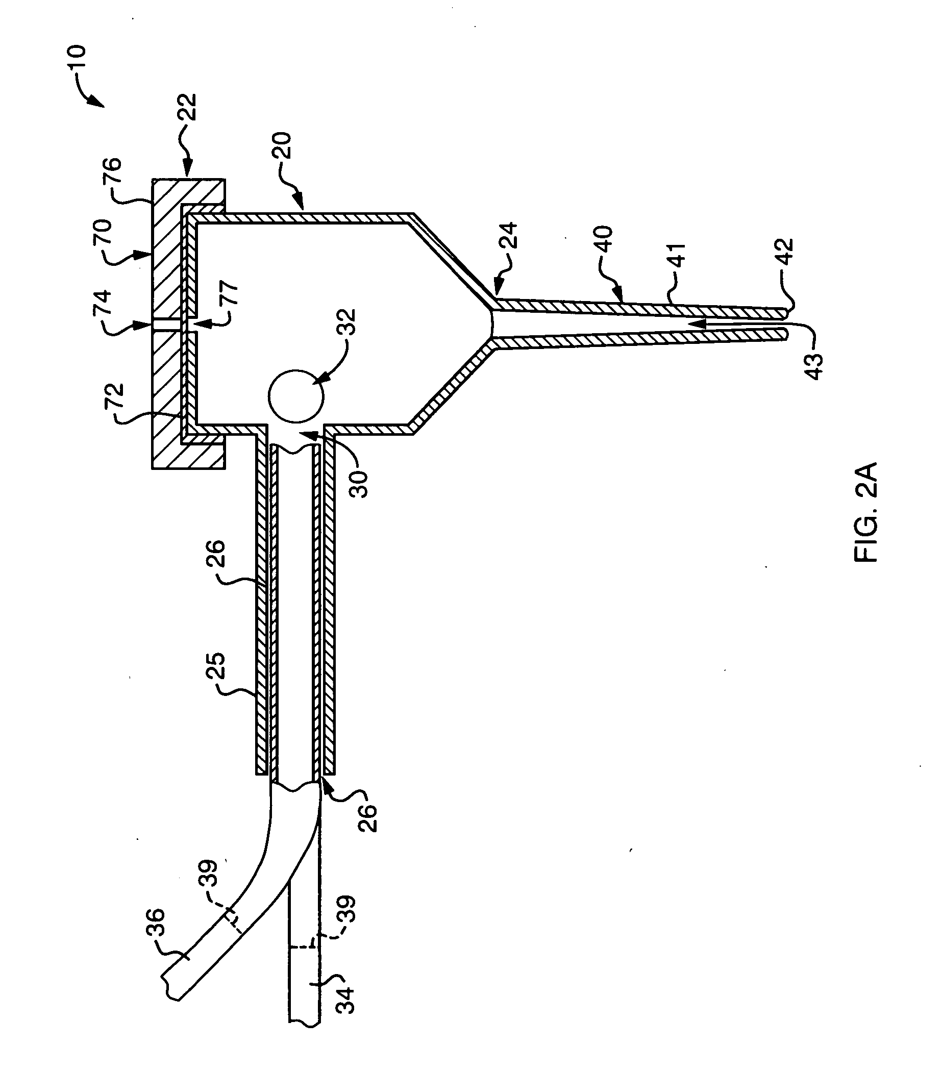 Ductal lavage microcatheter with user activated valve and Nitinol introducer