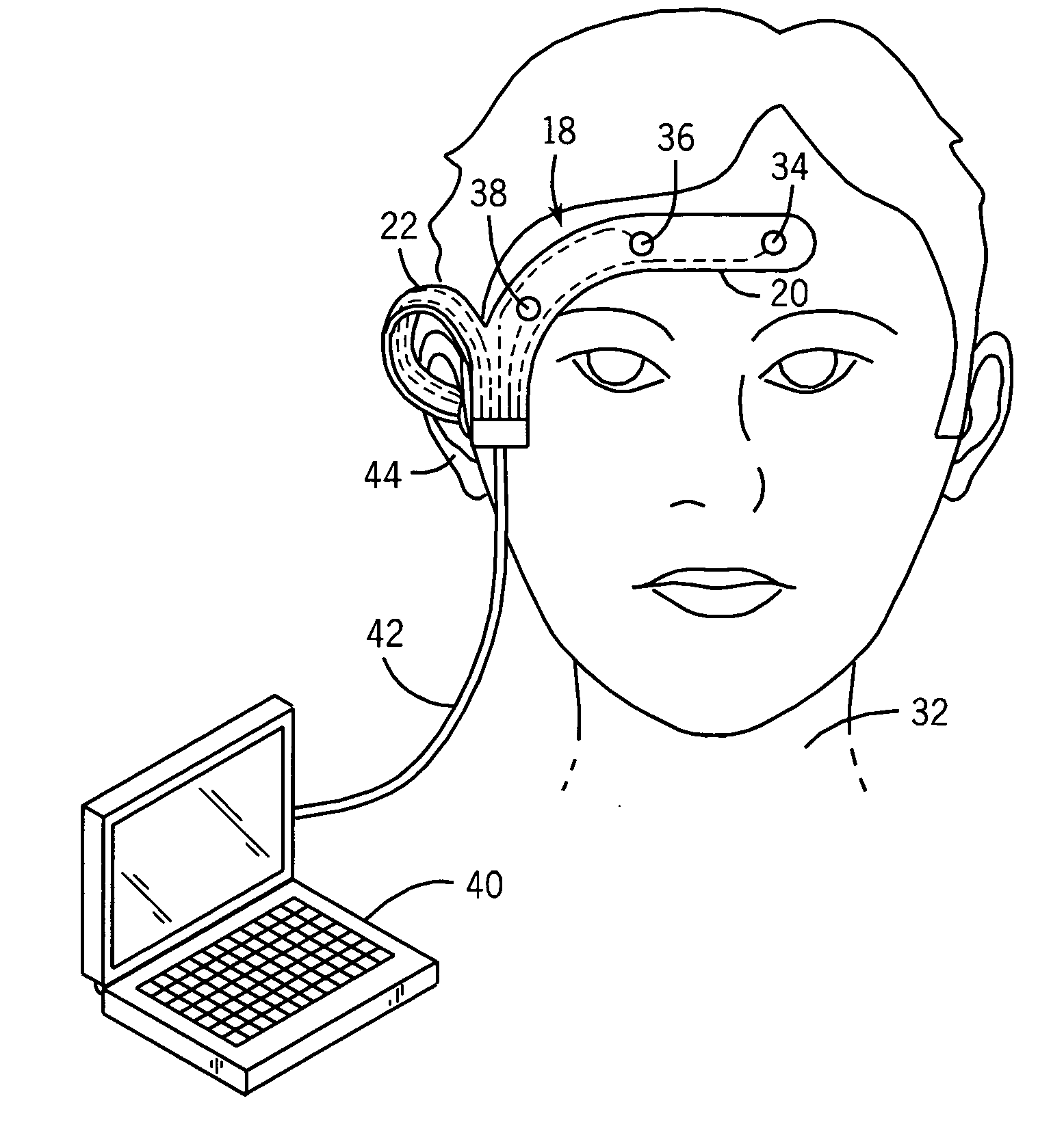 Combined passive and active neuromonitoring method and device