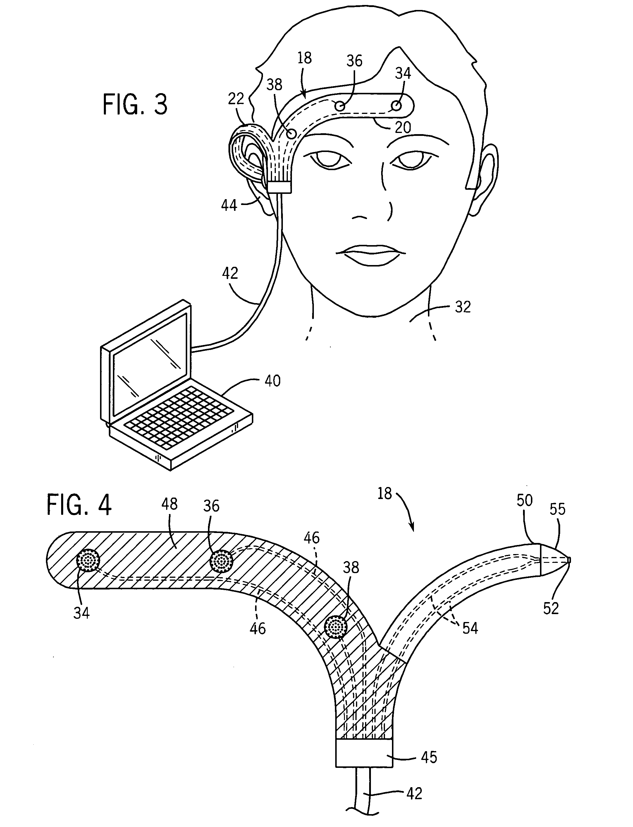 Combined passive and active neuromonitoring method and device