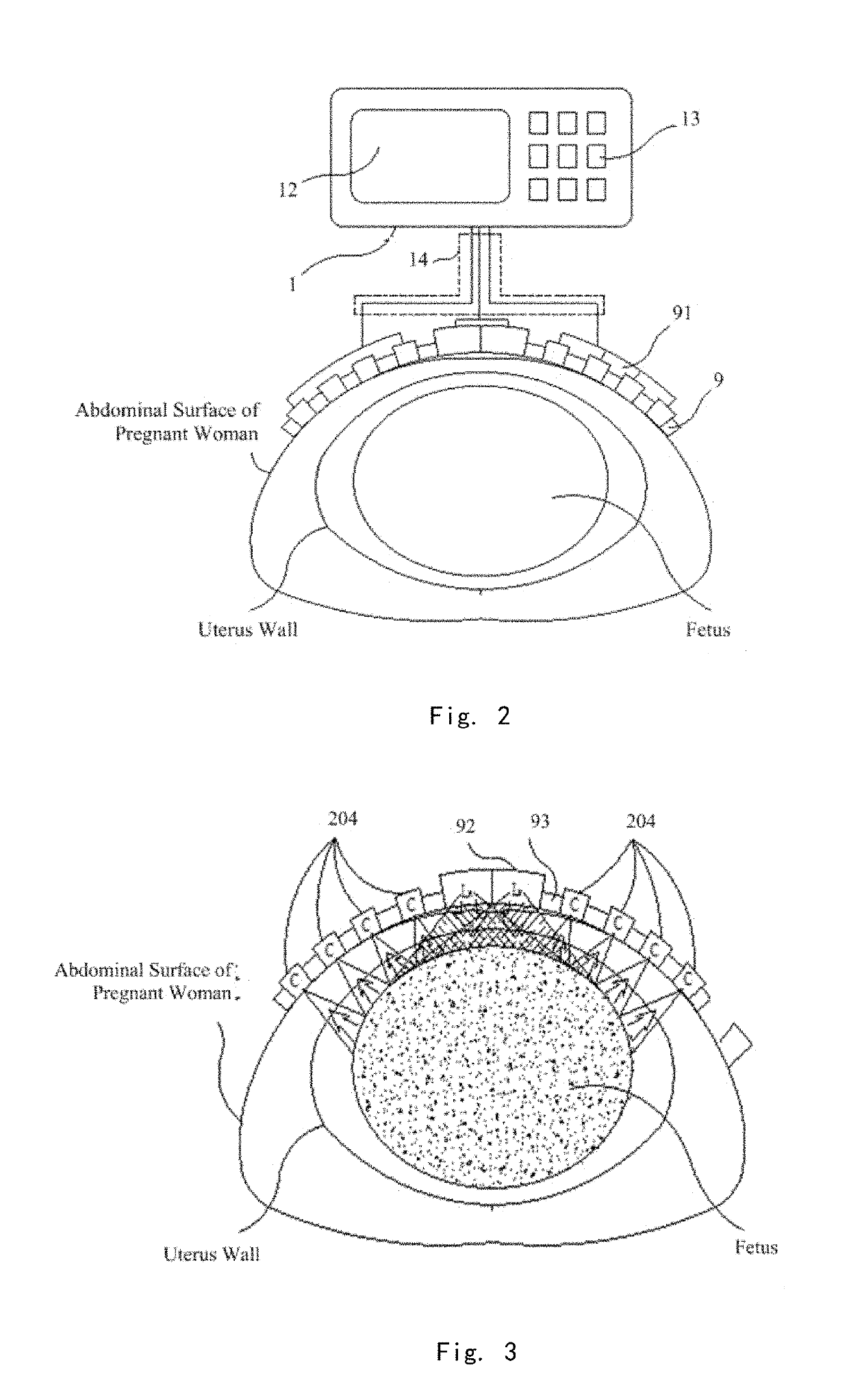 Trans-abdominal non-invasive fetal blood oxygen saturation detection device