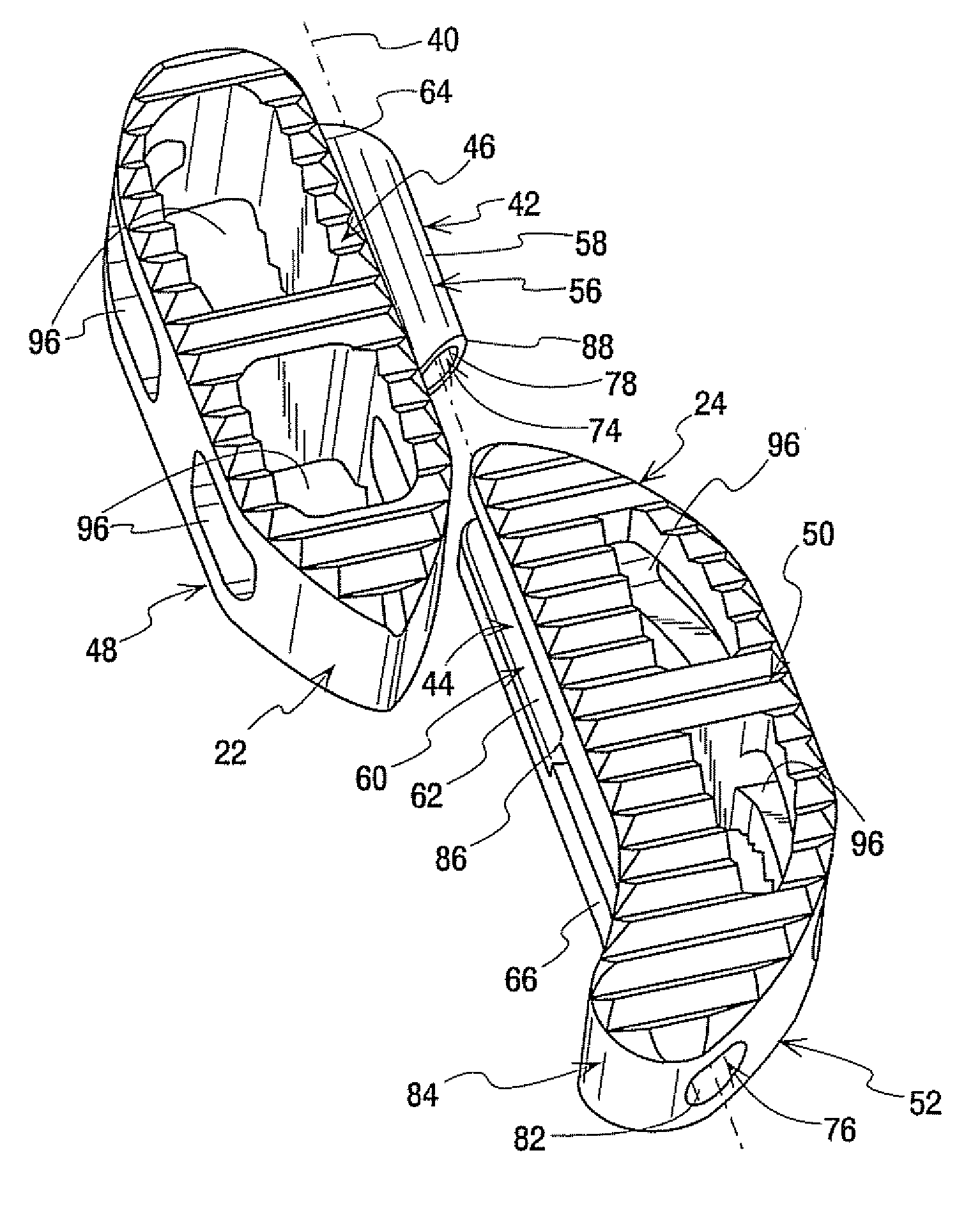 Interbody implant