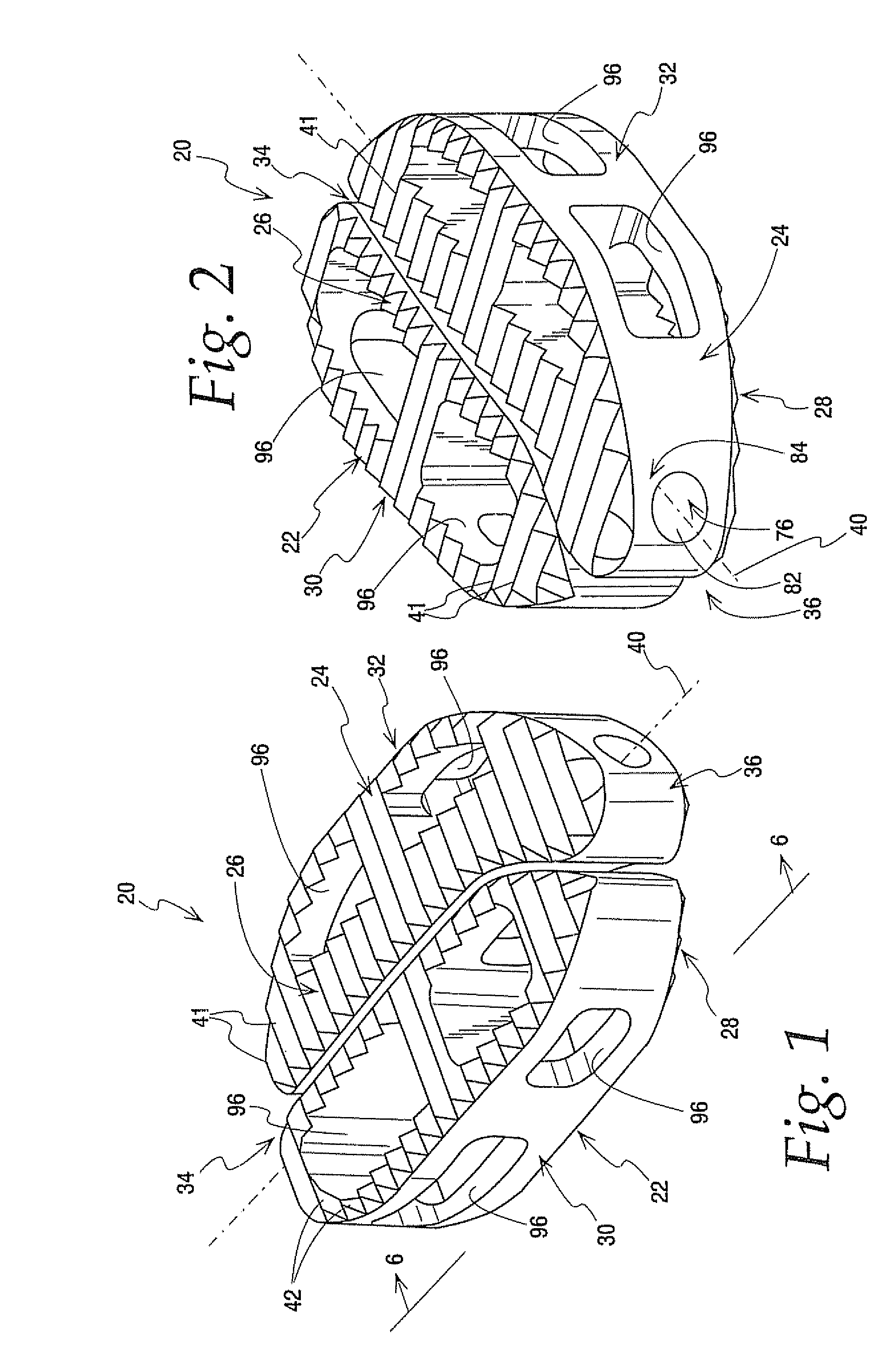 Interbody implant