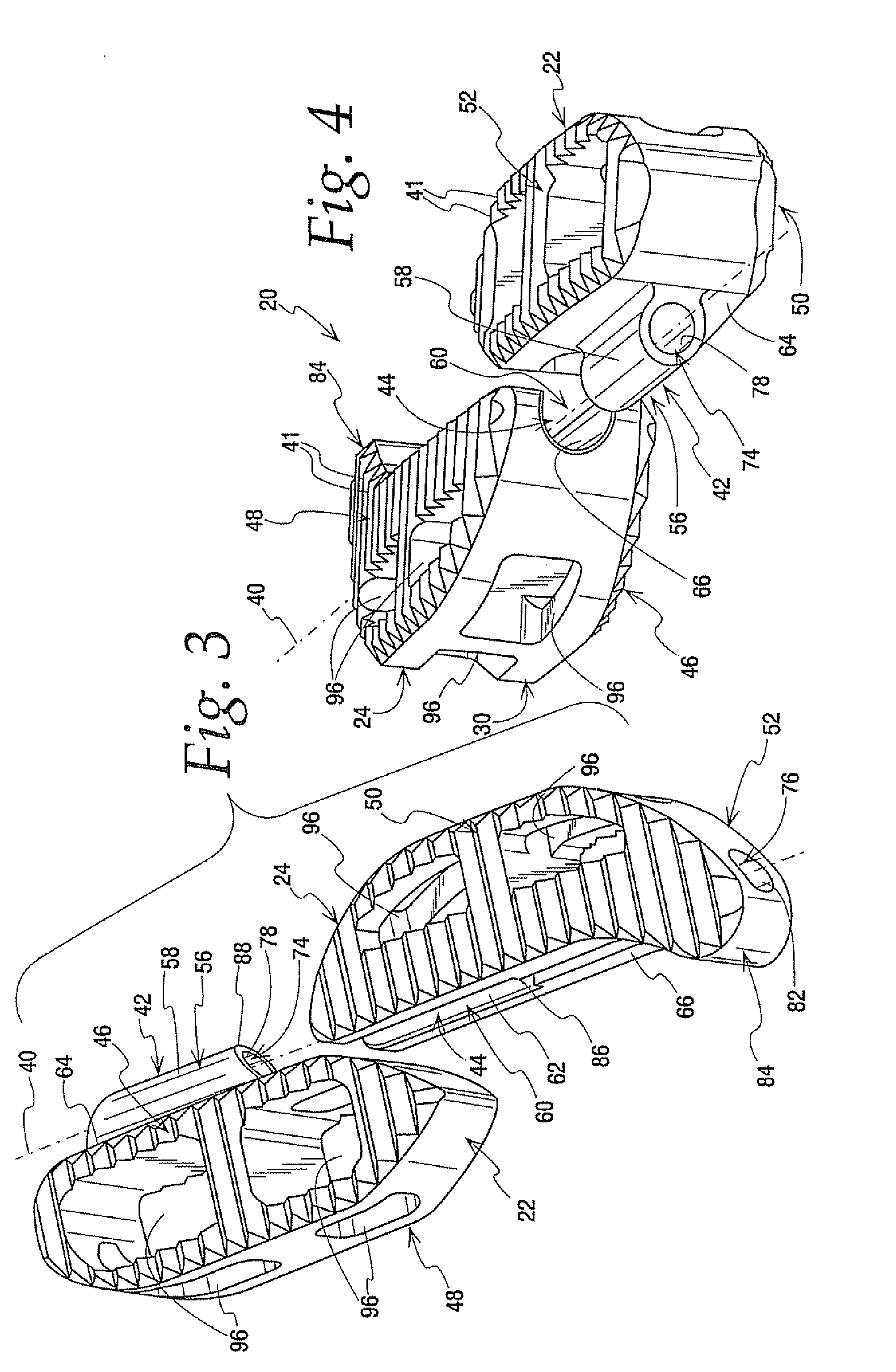 Interbody implant