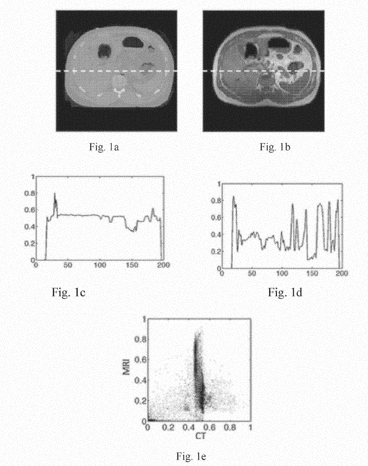 Simultaneous ct-mri image reconstruction