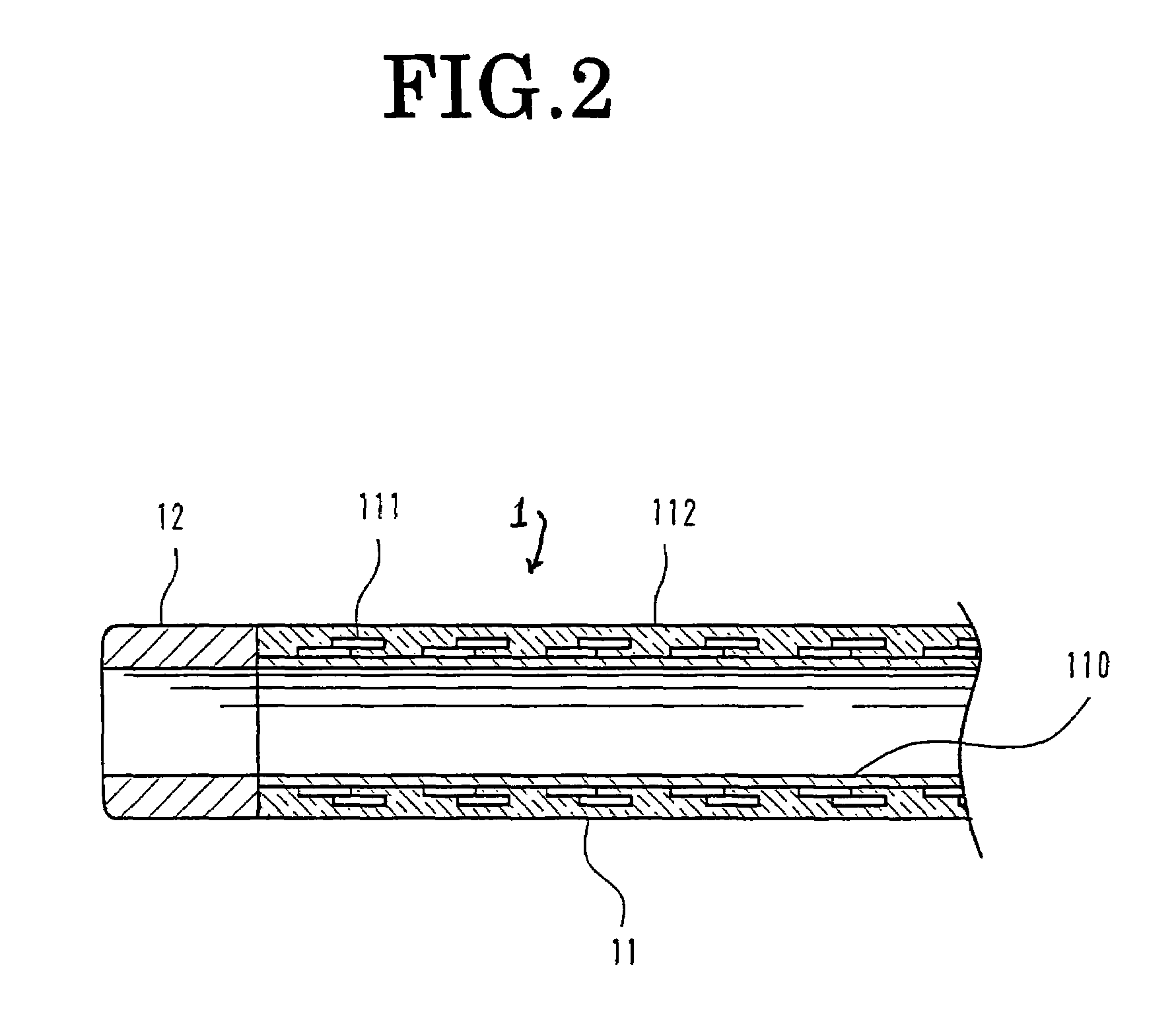 Intravascular foreign matter suction assembly