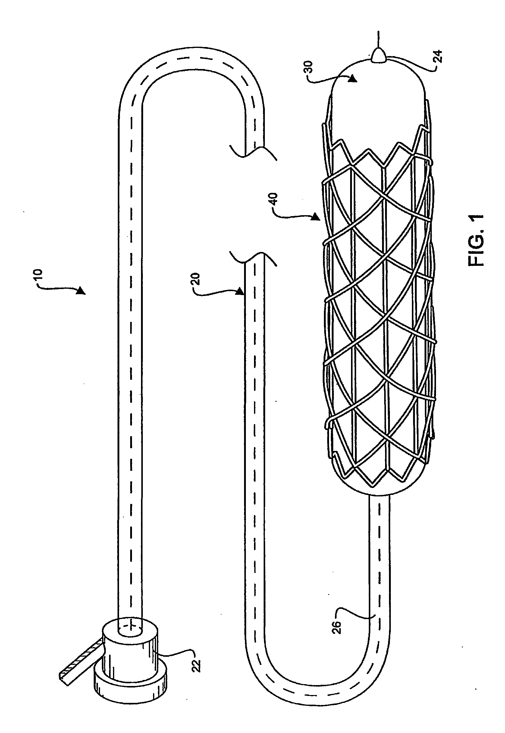 Hybrid Biodegradable/Non-Biodegradable Stent, Delivery System and Method of Treating a Vascular Condition