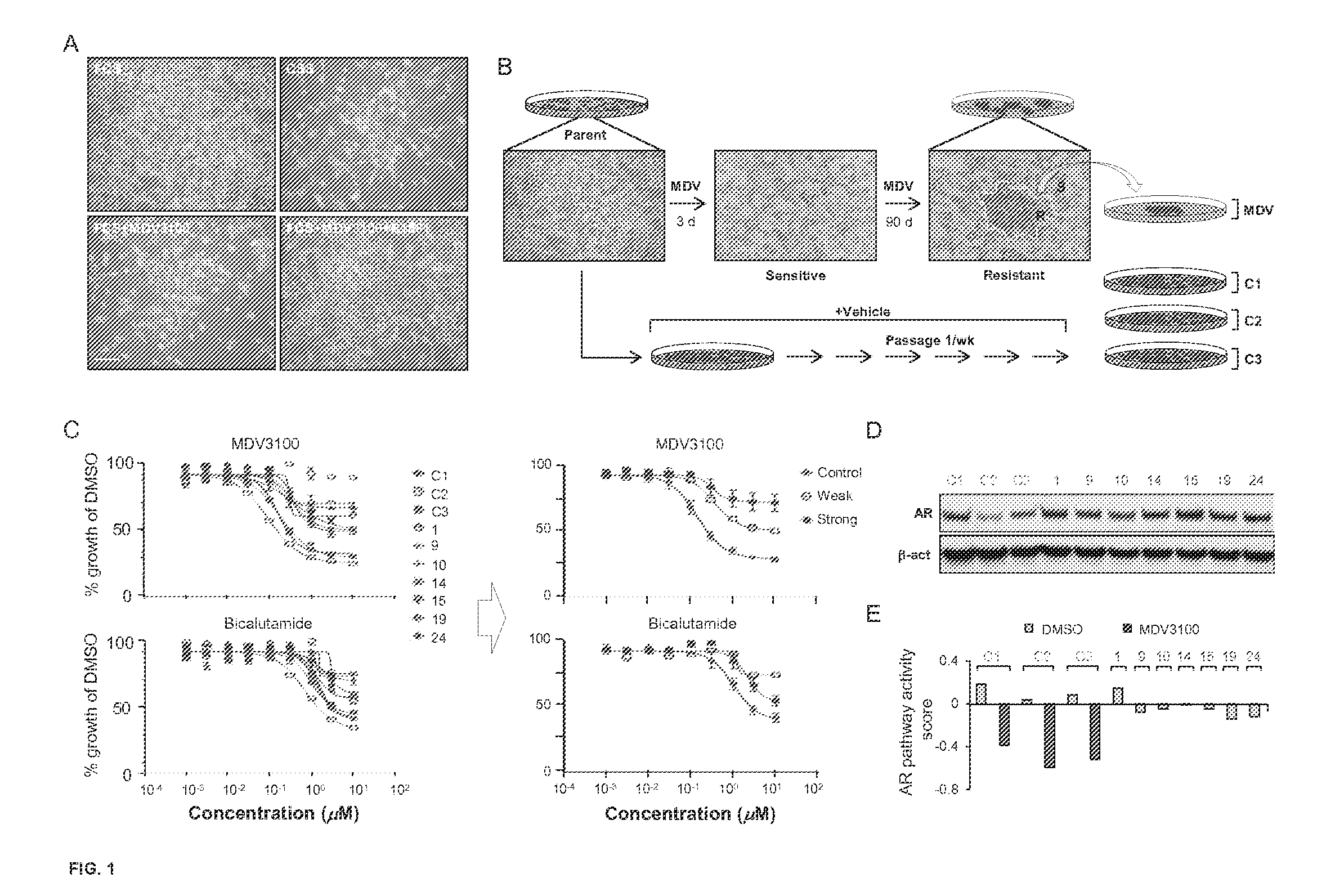 Novel androgen receptor mutation