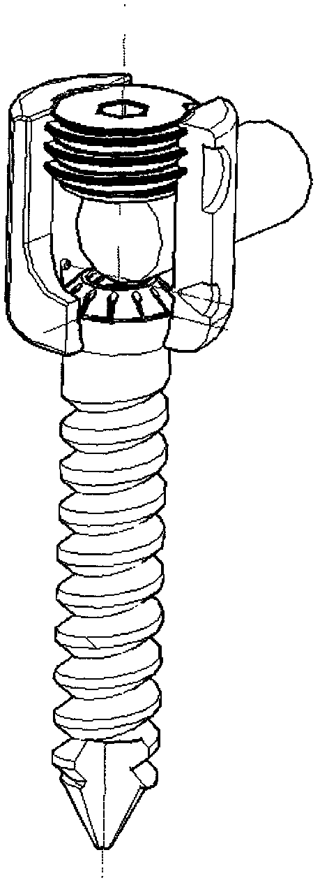 Low-cut simple micro-dynamic pedicle screw