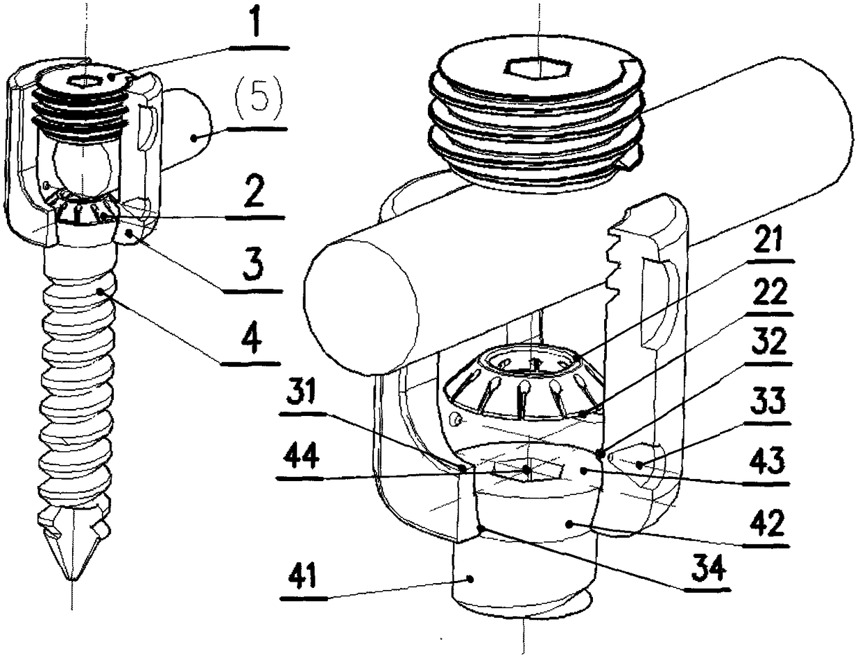 Low-cut simple micro-dynamic pedicle screw