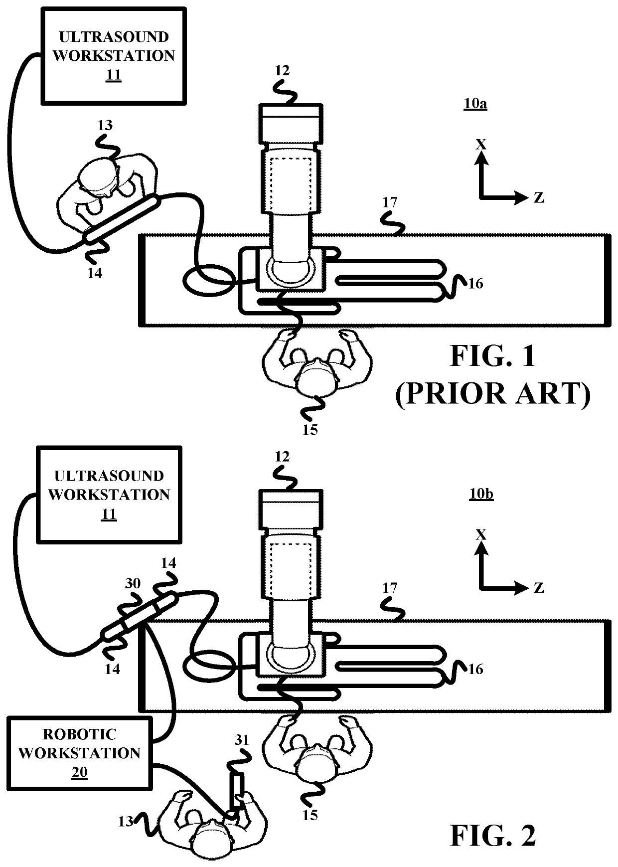 Remote robotic actuation of a transesophageal echocardiography probe