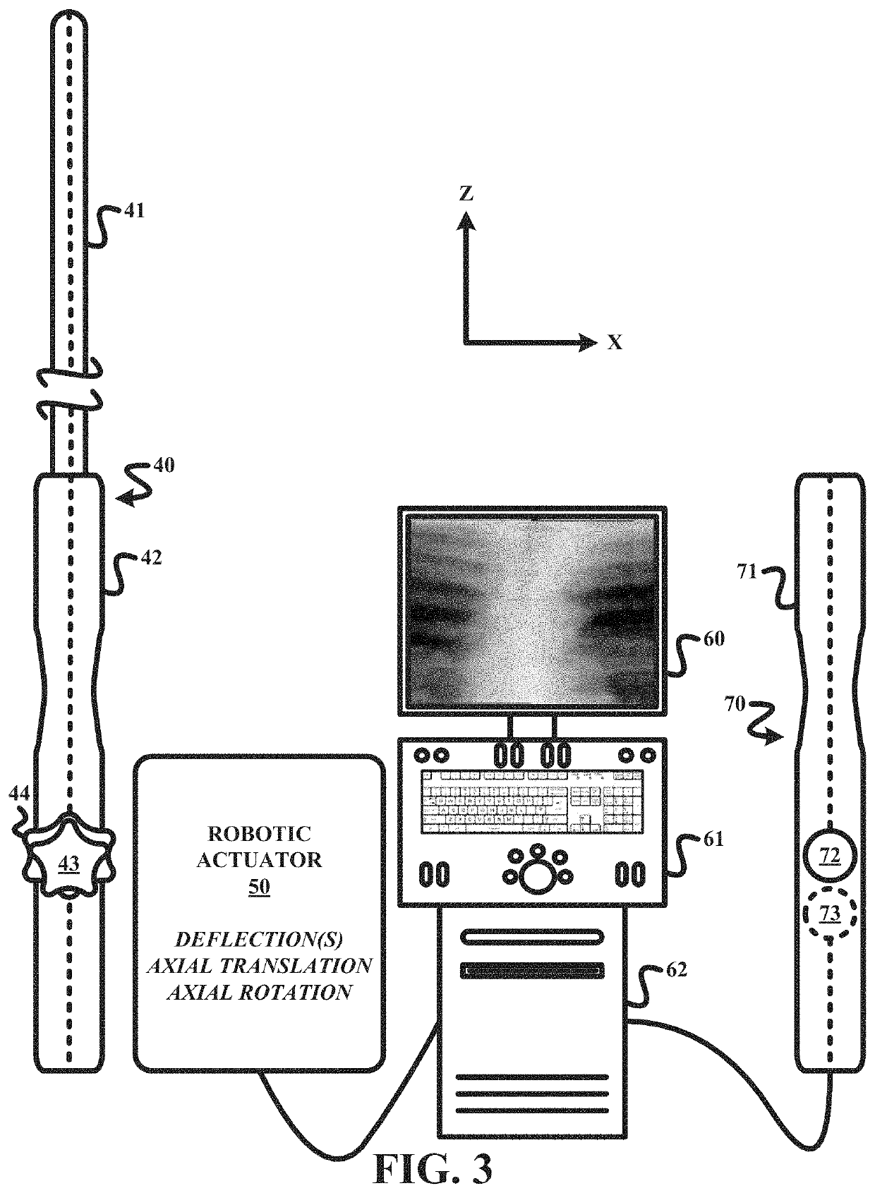 Remote robotic actuation of a transesophageal echocardiography probe