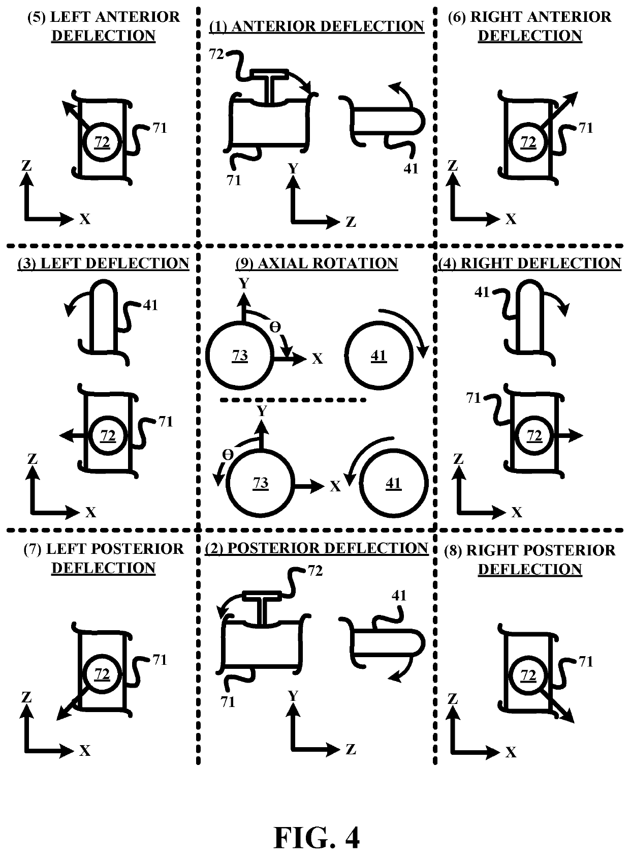 Remote robotic actuation of a transesophageal echocardiography probe