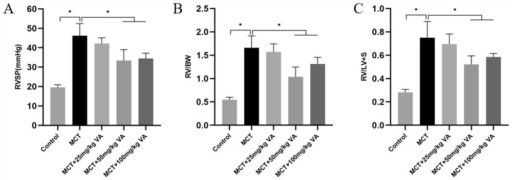 Arginase inhibitor as well as pharmaceutical composition and application thereof