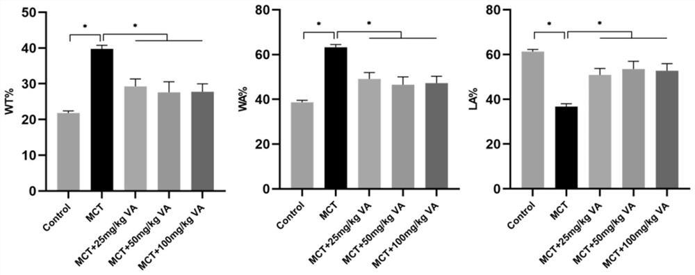 Arginase inhibitor as well as pharmaceutical composition and application thereof