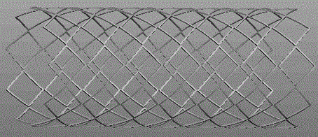 Woven fully-degradable magnesium alloy airway stent and preparation method thereof