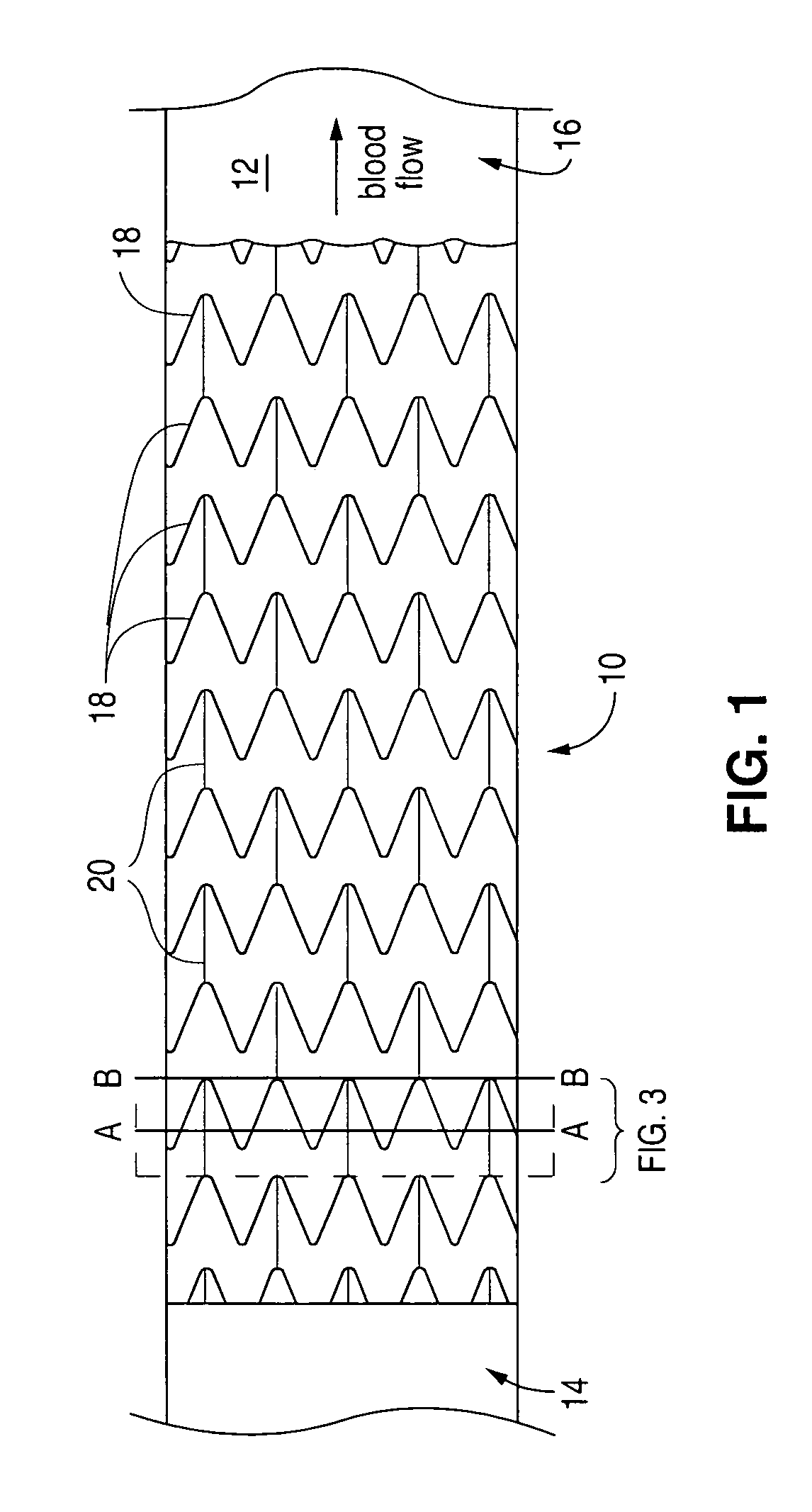 Stent with drug coating